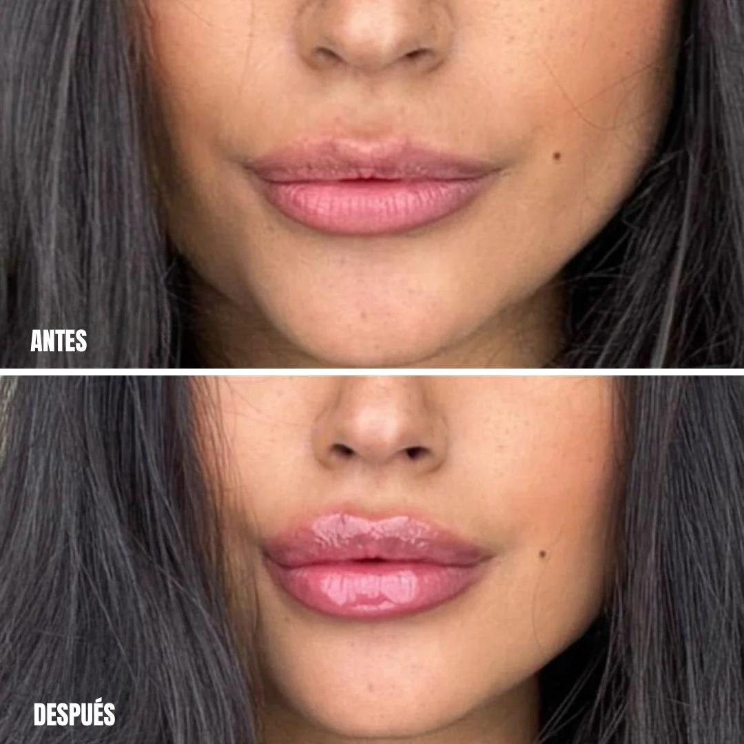 Voluminizador de Labios Natural con Efecto Inmediato y Resultados Extremos para una Hidratación Intensa (OFERTA 2X1)