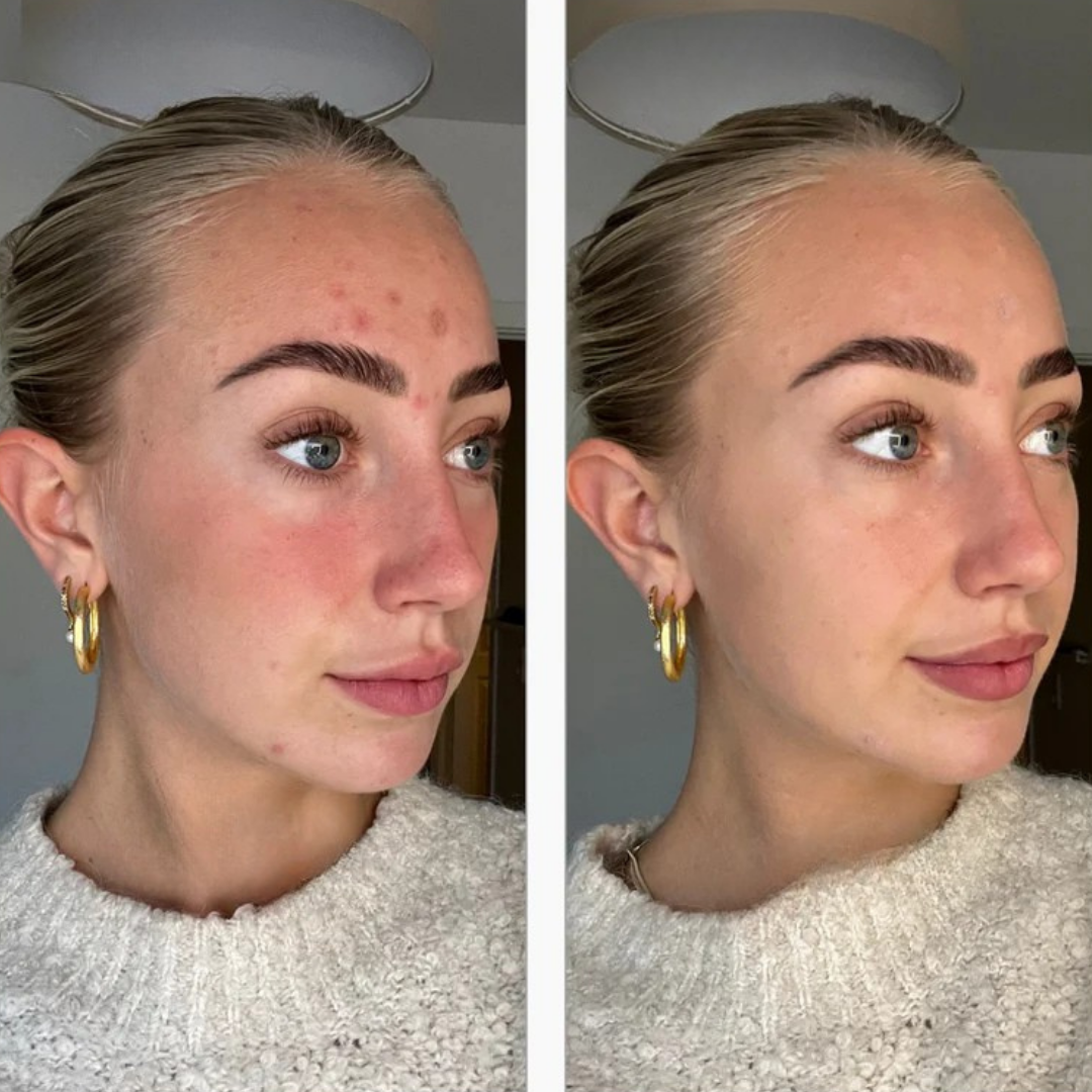 Base de Maquillaje Facial Hidratante con Fórmula Regeneradora y Textura Ligera (OFERTA 2X1)
