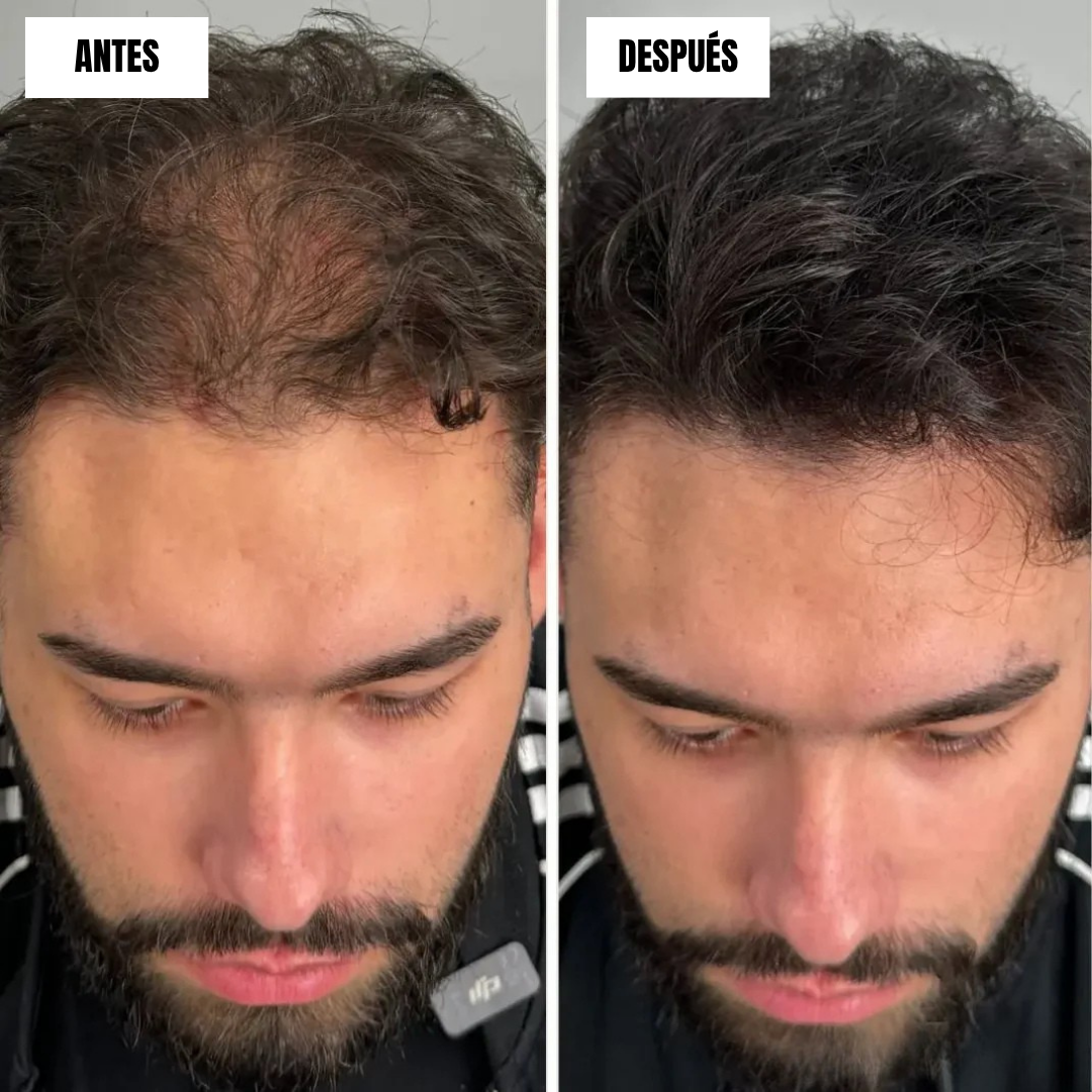 Crema Capilar con Efecto Volumen Instantáneo (OFERTA 2X1)