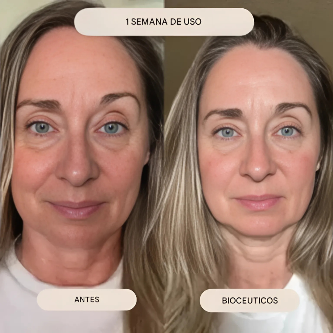 Mini Kit Microinfusión Facial de Sérum Antienvejecimiento