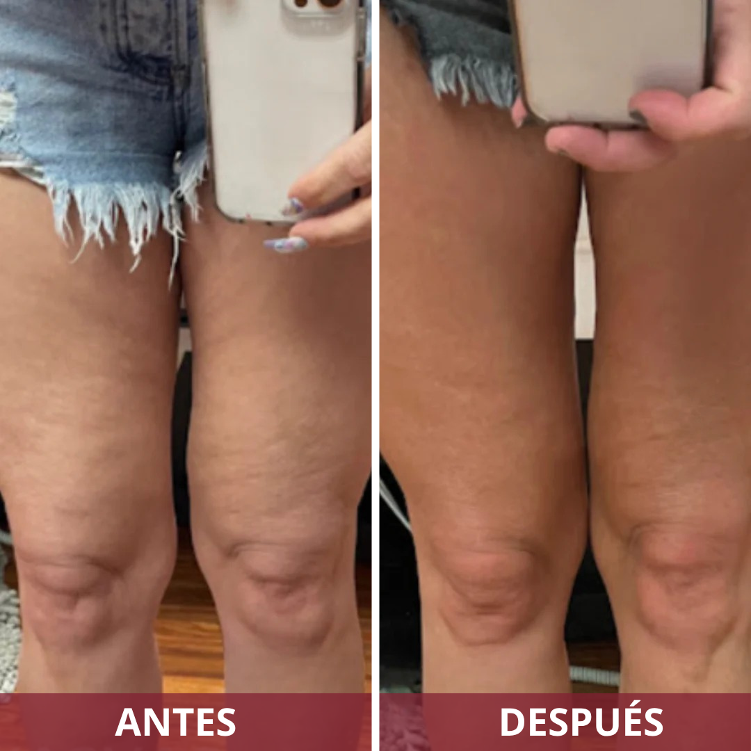 Masajeador multifuncional anticelulitis