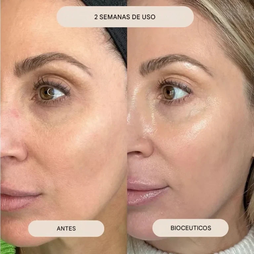 Mini Kit Microinfusión Facial de Sérum Antienvejecimiento