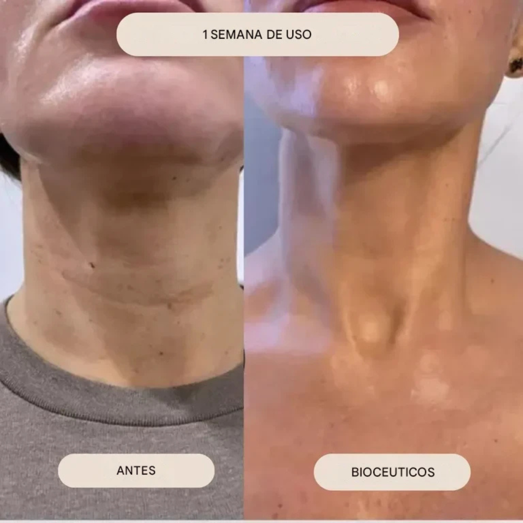 Mini Kit Microinfusión Facial de Sérum Antienvejecimiento