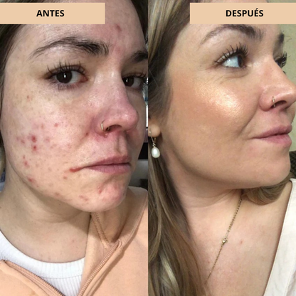 Crema Ligera e Hidratante para un Acabado Radiante y Natural (OFERTA 2X1)