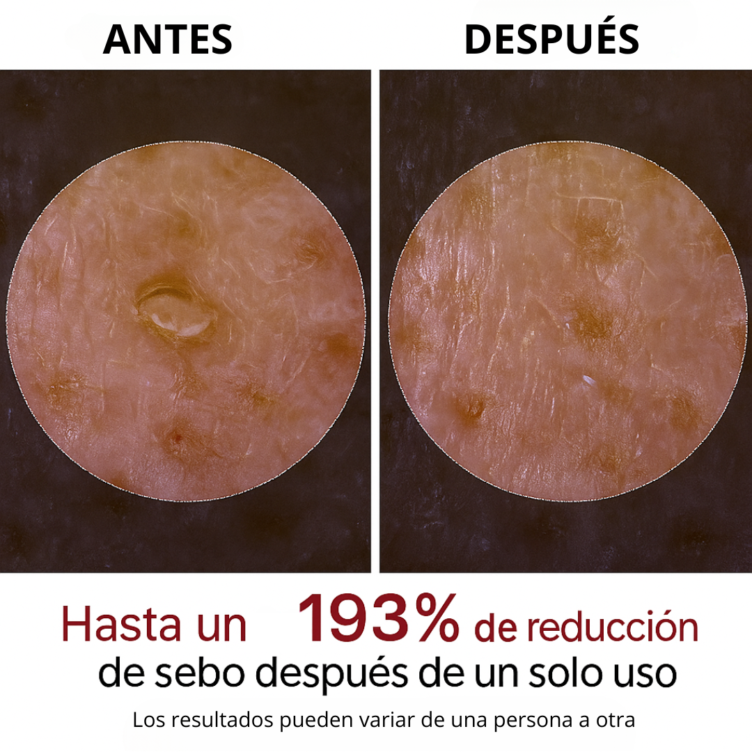 Suero Facial de Arroz para Exfoliación Suave y Luminosidad Natural (OFERTA 2X1)
