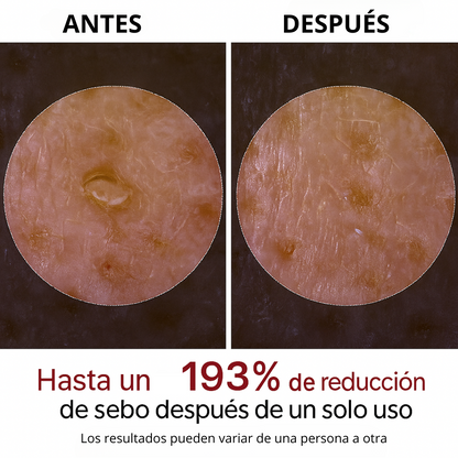 Suero Facial de Arroz para Exfoliación Suave y Luminosidad Natural (OFERTA 2X1)